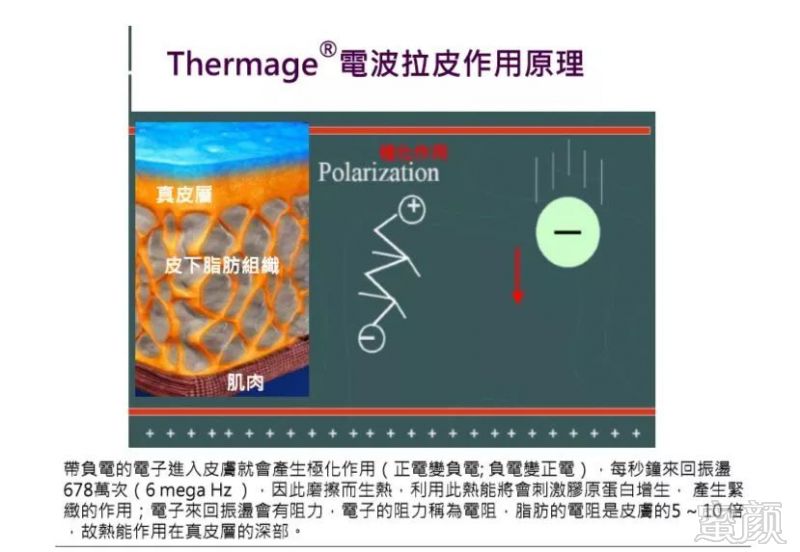 案例图片