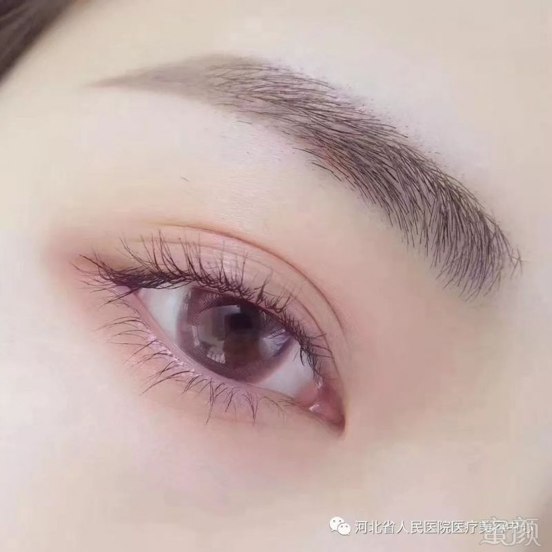 https://img.miyanlife.com/mnt/timg/180426/1234143541-1.jpg