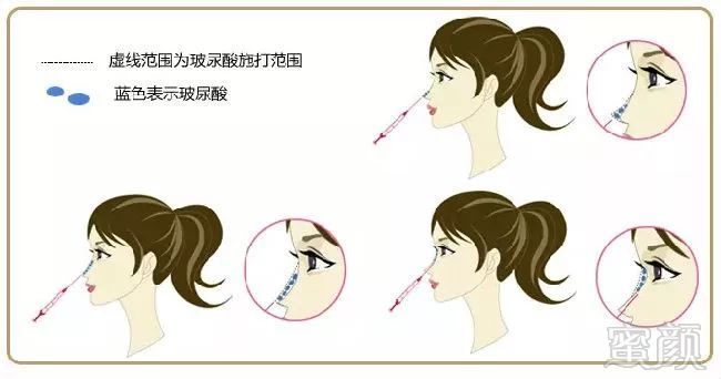 https://img.miyanlife.com/mnt/timg/180426/12355621B-7.jpg