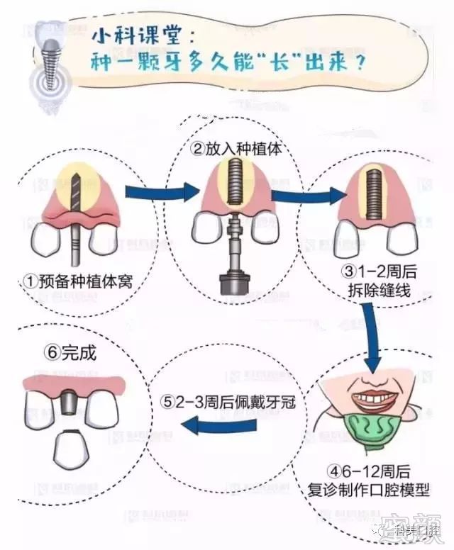 案例图片