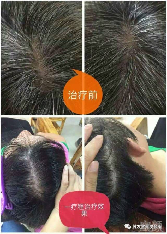 https://img.miyanlife.com/mnt/timg/180426/12563G544-3.jpg
