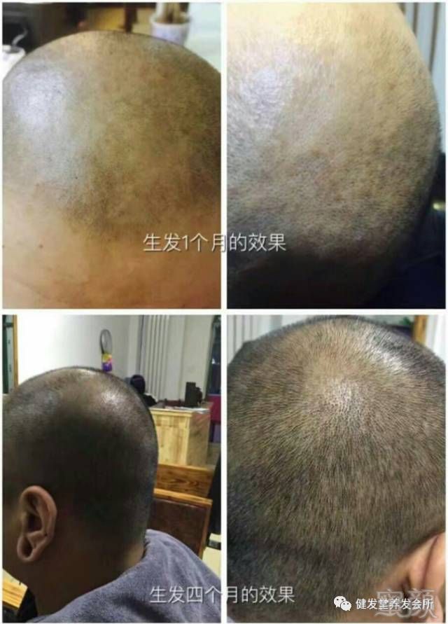 https://img.miyanlife.com/mnt/timg/180426/12563V2c-4.jpg