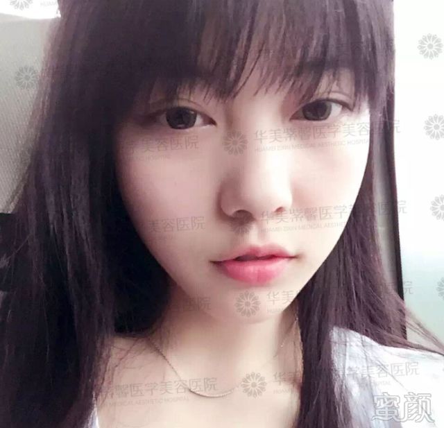 https://img.miyanlife.com/mnt/timg/180427/1055213043-5.jpg