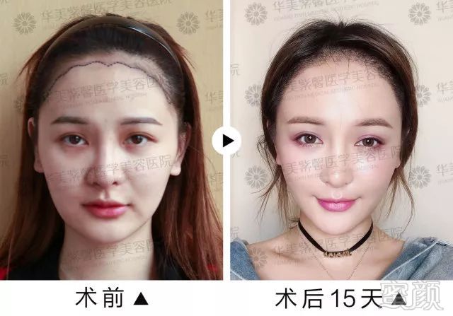 https://img.miyanlife.com/mnt/timg/180427/10552HL6-15.jpg