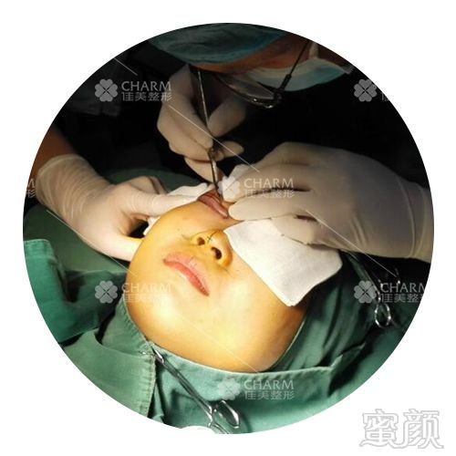 https://img.miyanlife.com/mnt/timg/180427/1121392323-9.jpg