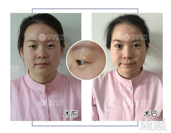 https://img.miyanlife.com/mnt/timg/180427/11213IV3-5.jpg