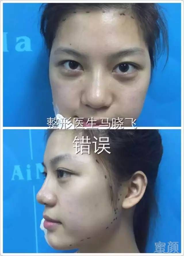 https://img.miyanlife.com/mnt/timg/180427/1159464396-0.jpg