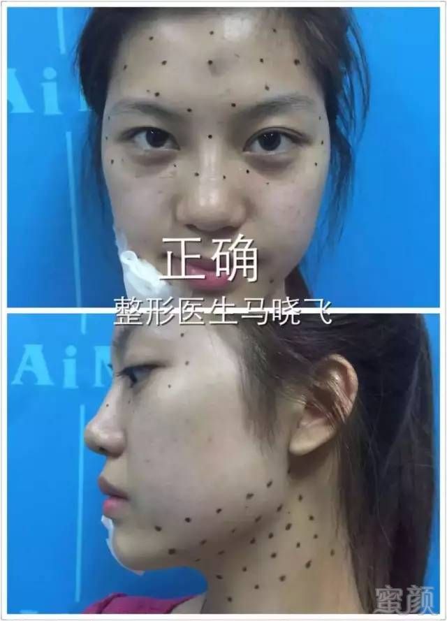 https://img.miyanlife.com/mnt/timg/180427/11594M150-2.jpg