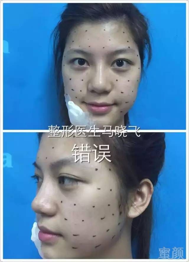 https://img.miyanlife.com/mnt/timg/180427/11594M414-1.jpg