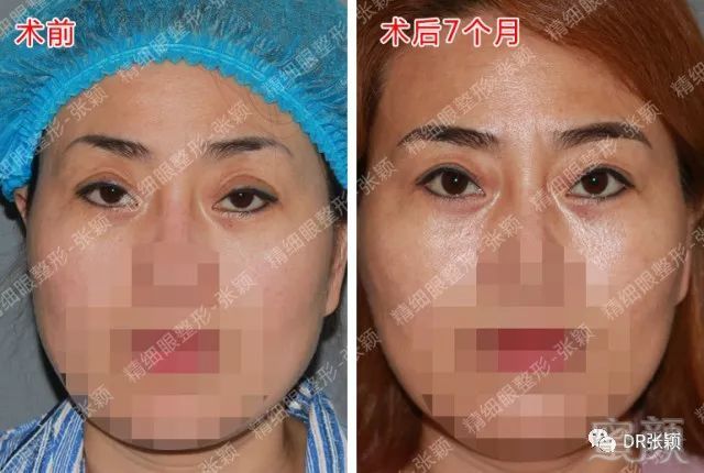https://img.miyanlife.com/mnt/timg/180427/120H93008-6.jpg