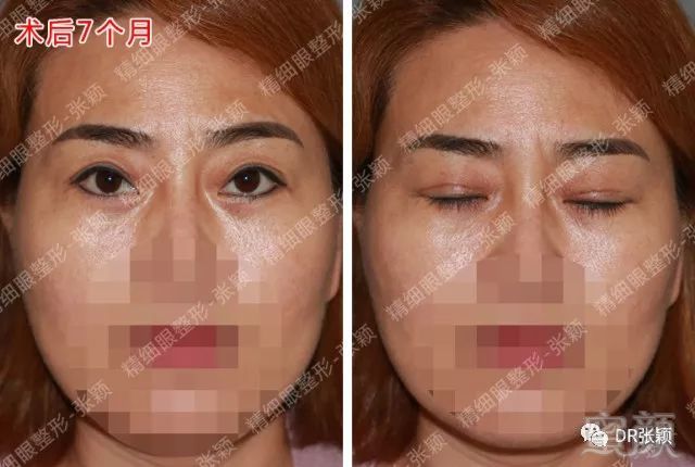 https://img.miyanlife.com/mnt/timg/180427/120HR4J-5.jpg