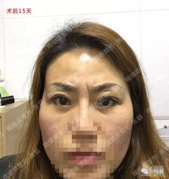https://img.miyanlife.com/mnt/timg/180427/120HVP2-3.jpg