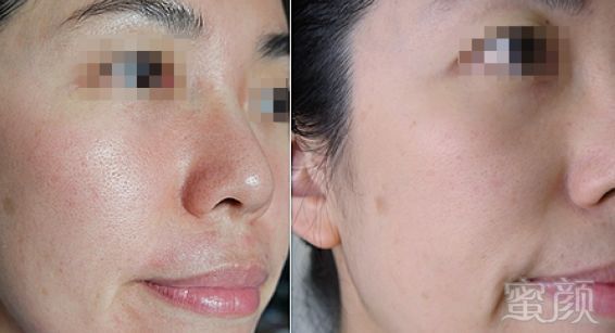 https://img.miyanlife.com/mnt/timg/180427/121450IG-4.jpg