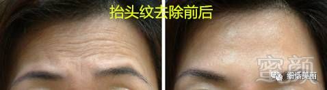https://img.miyanlife.com/mnt/timg/180427/1216093A2-7.jpg