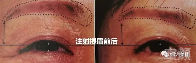 https://img.miyanlife.com/mnt/timg/180427/1216105G8-8.jpg
