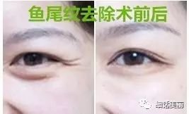 https://img.miyanlife.com/mnt/timg/180427/12161115W-9.jpg