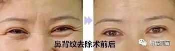 https://img.miyanlife.com/mnt/timg/180427/1216121I0-10.jpg