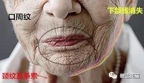 https://img.miyanlife.com/mnt/timg/180427/1216125923-11.jpg