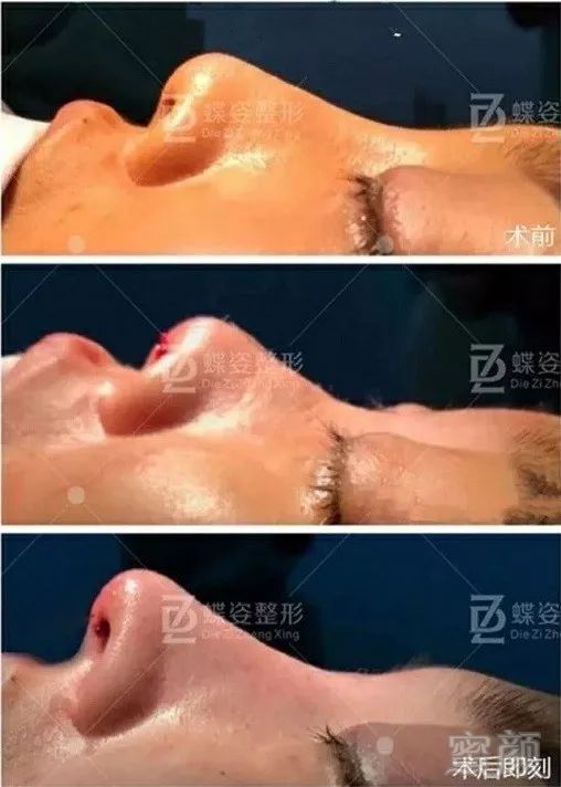 https://img.miyanlife.com/mnt/timg/180427/1216134060-2.jpg