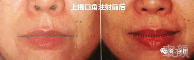 https://img.miyanlife.com/mnt/timg/180427/1216135X5-13.jpg