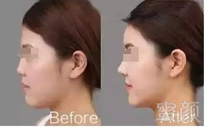 https://img.miyanlife.com/mnt/timg/180427/1219232019-4.jpg