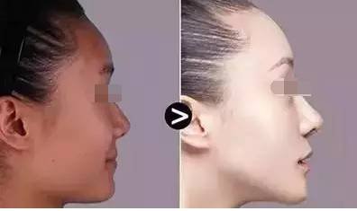 https://img.miyanlife.com/mnt/timg/180427/121923D13-3.jpg