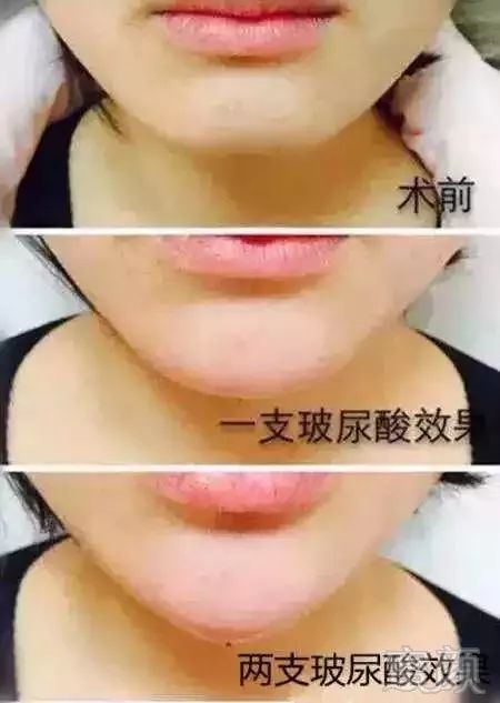 https://img.miyanlife.com/mnt/timg/180427/12192GH9-7.jpg