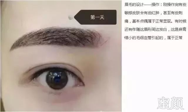 https://img.miyanlife.com/mnt/timg/180427/121ZC5Y-2.jpg