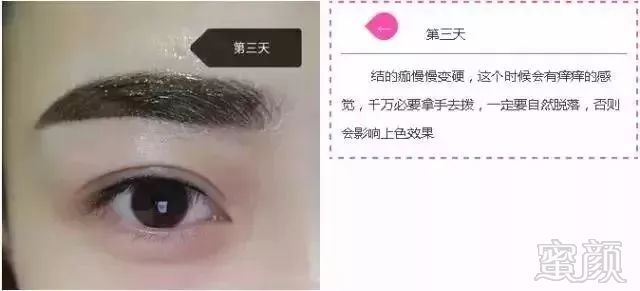 https://img.miyanlife.com/mnt/timg/180427/121ZGY7-6.jpg