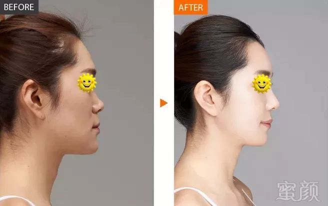 https://img.miyanlife.com/mnt/timg/180427/1231124c1-6.jpg