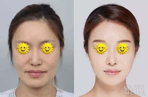 https://img.miyanlife.com/mnt/timg/180427/123112G63-7.jpg