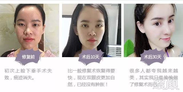 https://img.miyanlife.com/mnt/timg/180428/1101242123-6.jpg