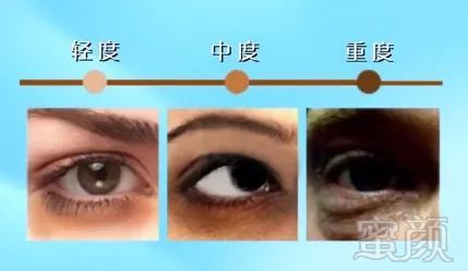 https://img.miyanlife.com/mnt/timg/180428/1111596337-3.jpg