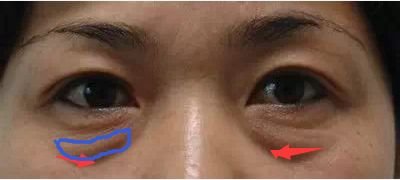 https://img.miyanlife.com/mnt/timg/180428/11115T649-1.jpg