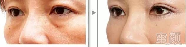 https://img.miyanlife.com/mnt/timg/180428/11162912Z-9.jpg
