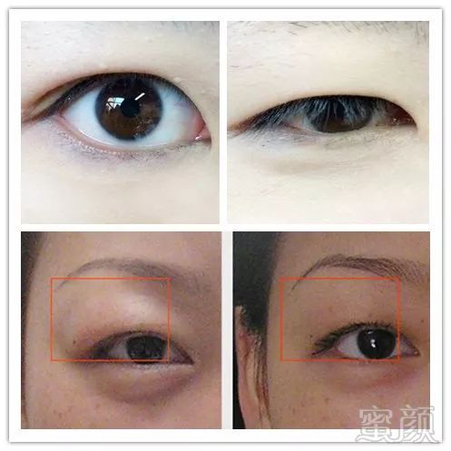 https://img.miyanlife.com/mnt/timg/180428/11162933b-5.jpg