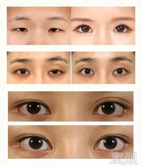 https://img.miyanlife.com/mnt/timg/180428/11162R926-4.jpg