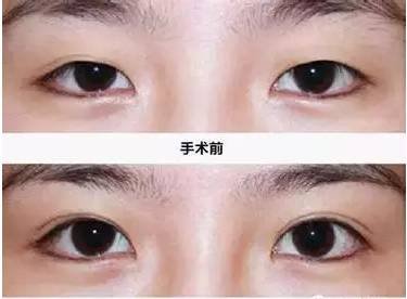 https://img.miyanlife.com/mnt/timg/180428/1116301F6-11.jpg