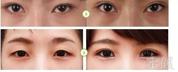https://img.miyanlife.com/mnt/timg/180428/11163023Z-12.jpg