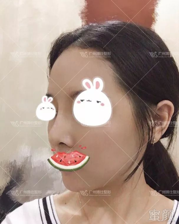 https://img.miyanlife.com/mnt/timg/180428/112910L50-7.jpg
