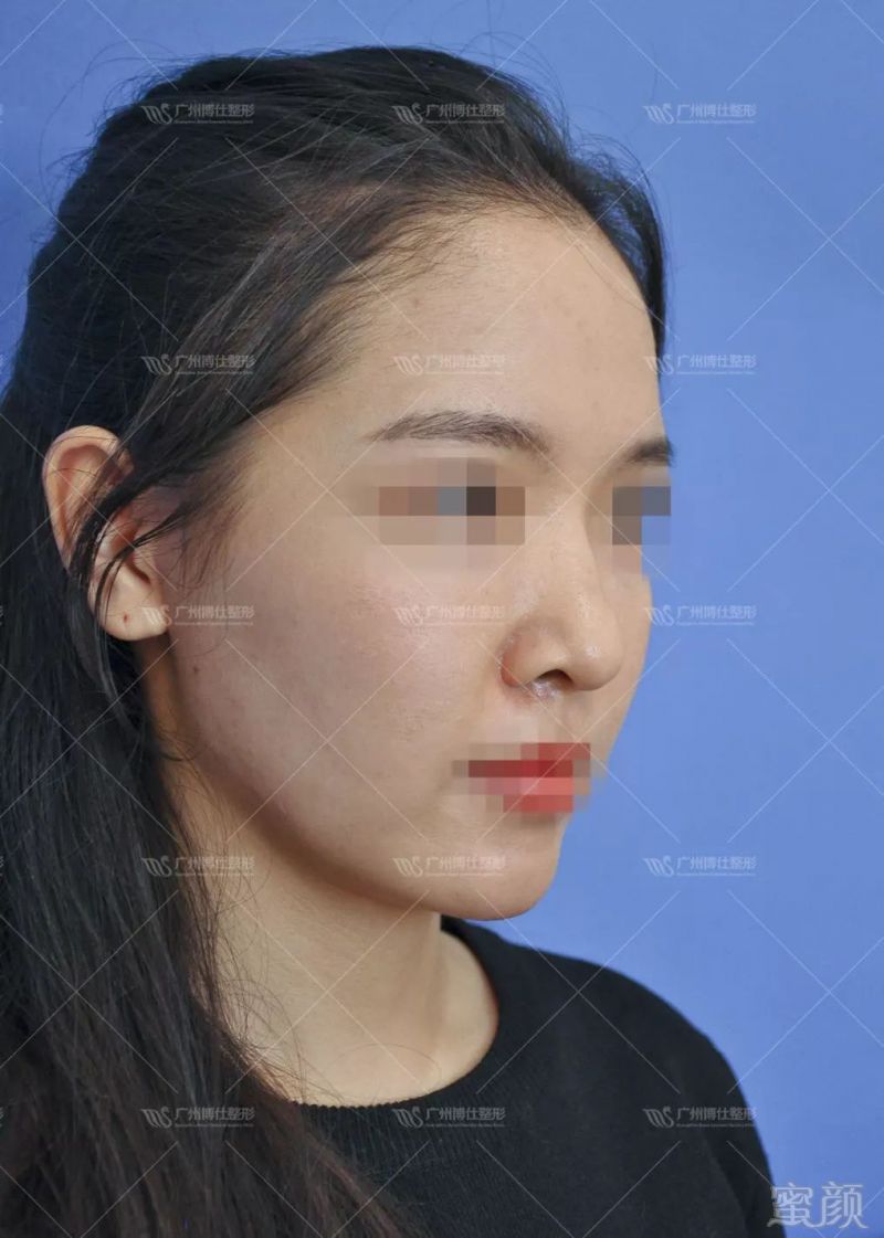 https://img.miyanlife.com/mnt/timg/180428/112ZM022-1.jpg