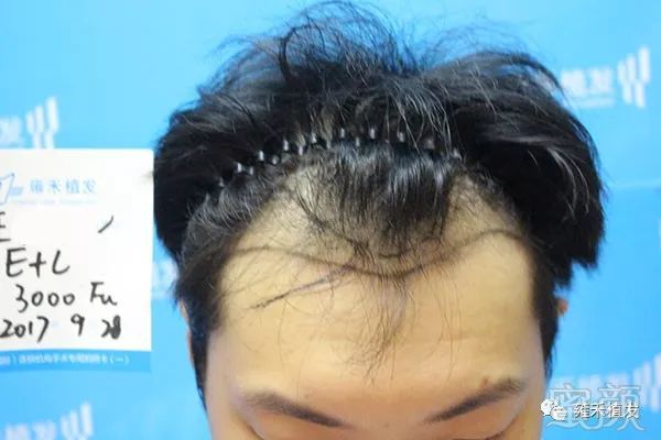 https://img.miyanlife.com/mnt/timg/180428/1143325C7-1.jpg