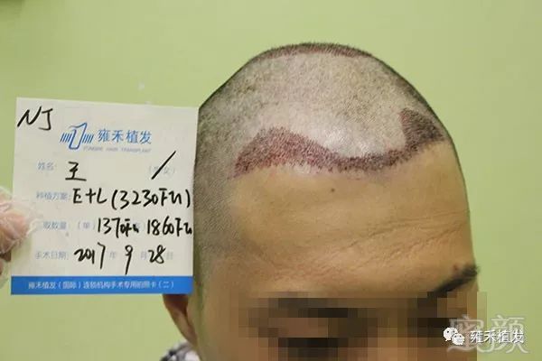 https://img.miyanlife.com/mnt/timg/180428/11433AC8-7.jpg