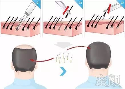 https://img.miyanlife.com/mnt/timg/180428/11434K0U-2.jpg
