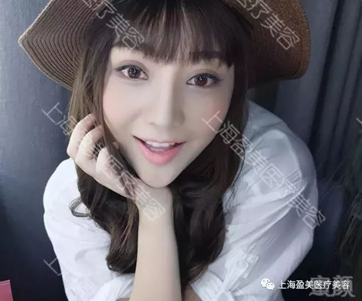 https://img.miyanlife.com/mnt/timg/180428/114R14532-6.jpg