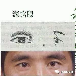 案例图片