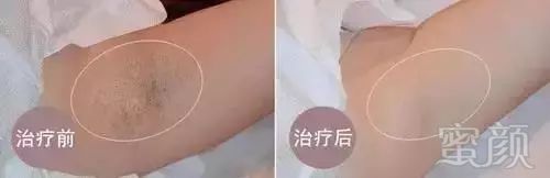 https://img.miyanlife.com/mnt/timg/180428/1200211525-1.jpg