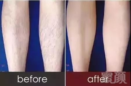 https://img.miyanlife.com/mnt/timg/180428/120021G33-2.jpg