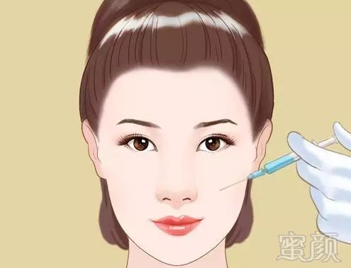 https://img.miyanlife.com/mnt/timg/180428/12115H1F-1.jpg