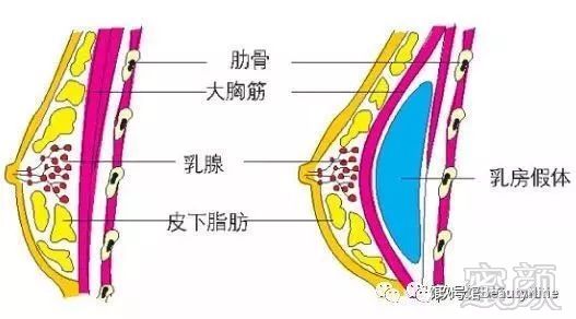 案例图片